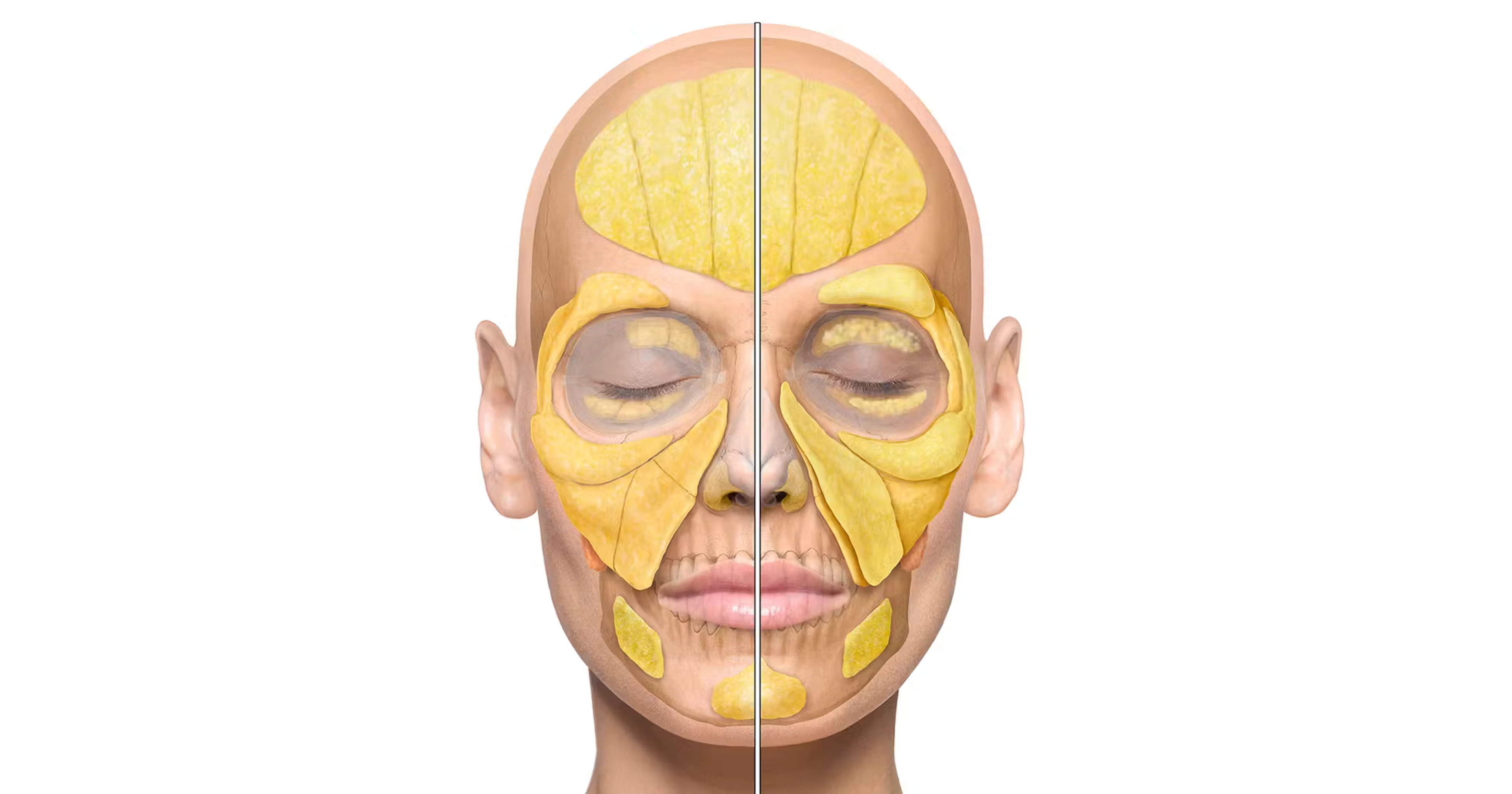 Intermediate Fat Compartments facial schematic