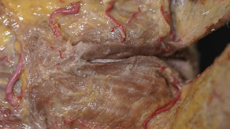 Understanding and Avoiding Toxin-related Adverse Events: DAO & DLI Muscles