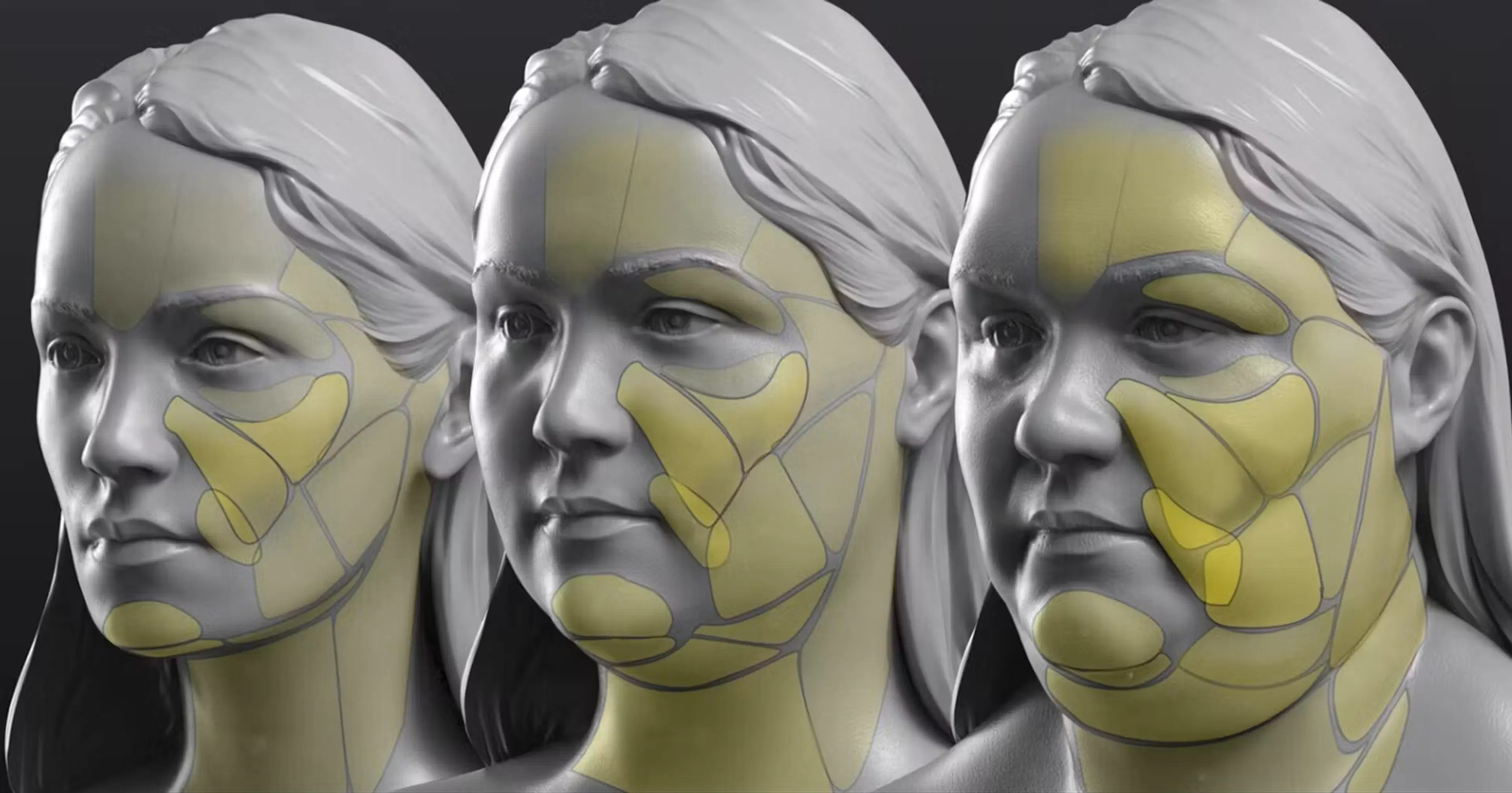Superficial Fat Compartments of the Face illustration