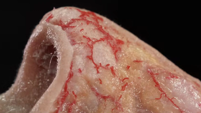 Basic Anatomy and Danger Zones: Nose