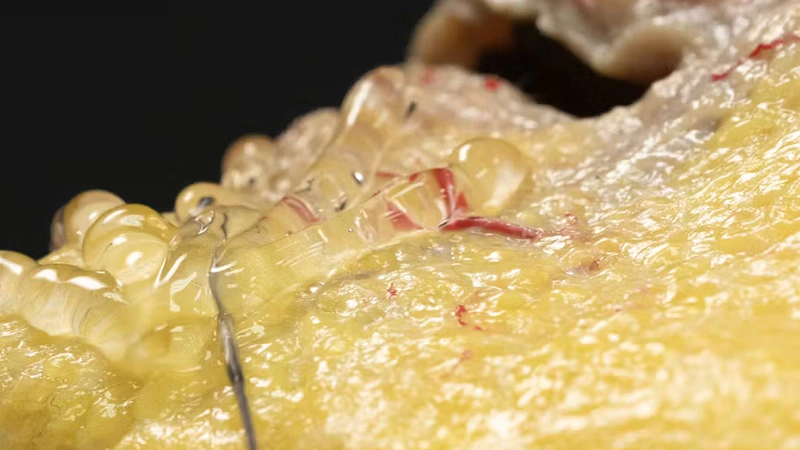 Oral Commissure Support with Cannula