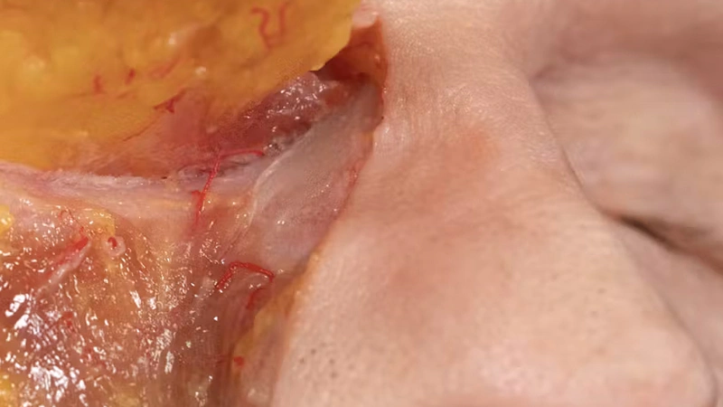 Soft Tissue - Review: Middle Face