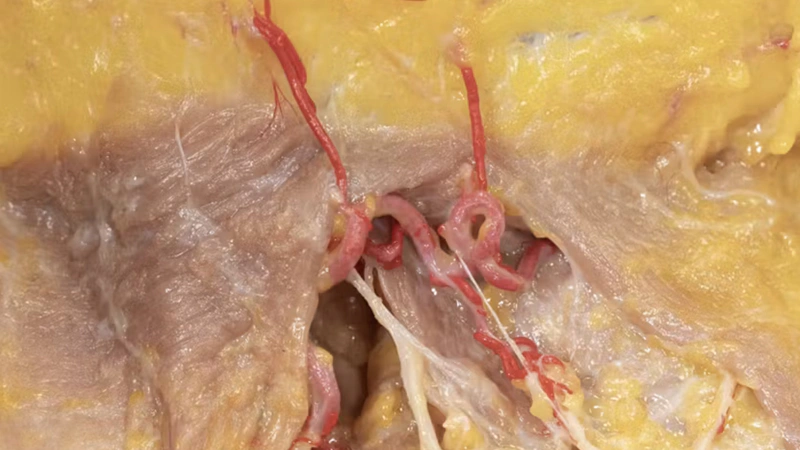 Basic Anatomy for Neuromodulator Treatments: Orbicularis Oris Muscle