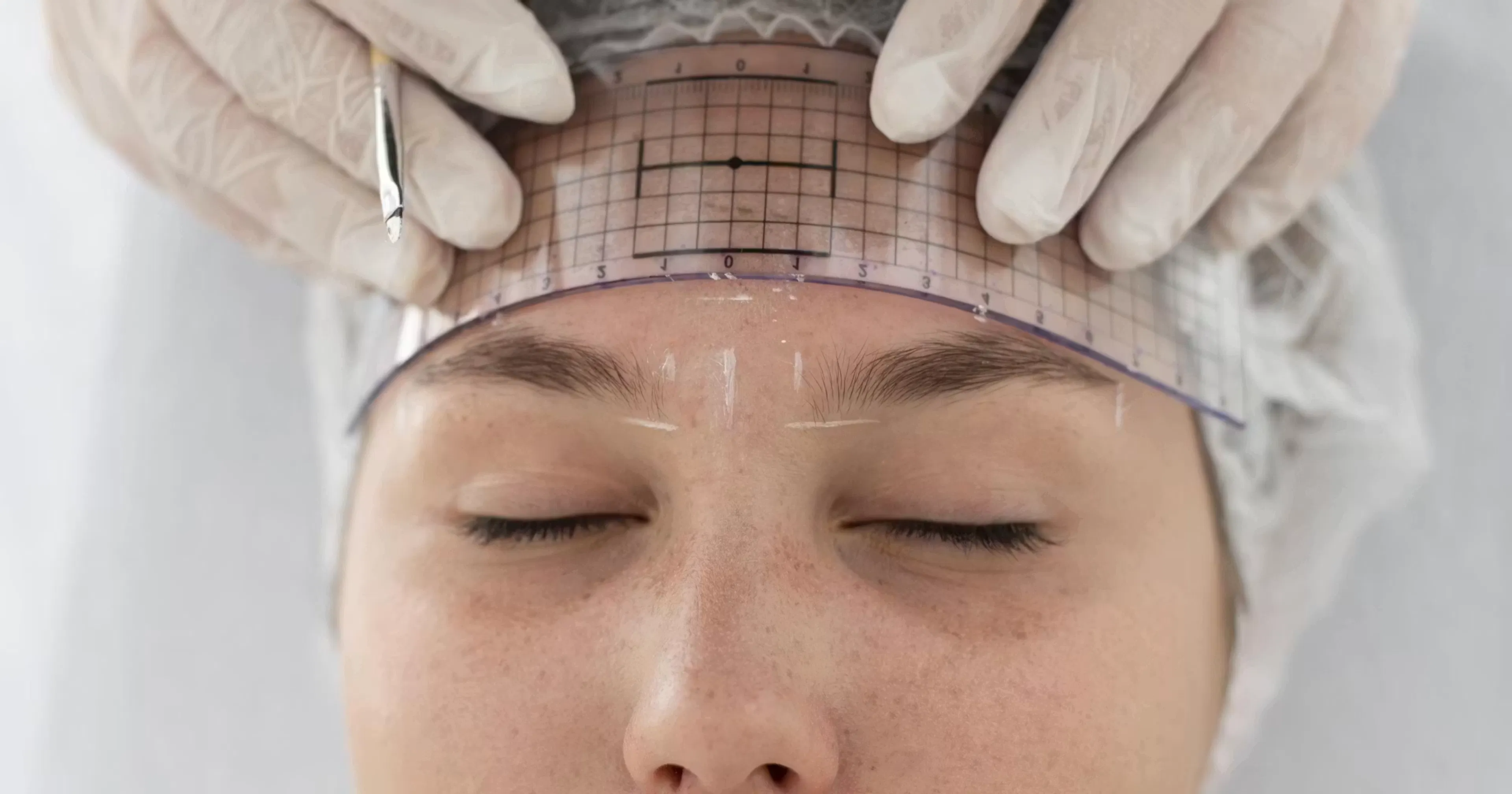 Patient having her Glabella measured by a clinician