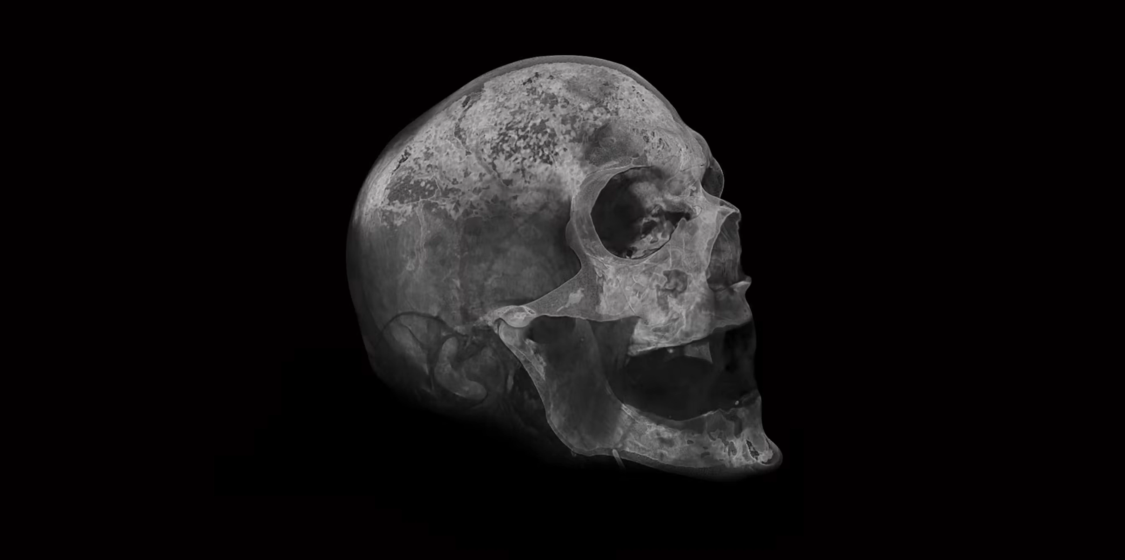 Skull x-ray image on black