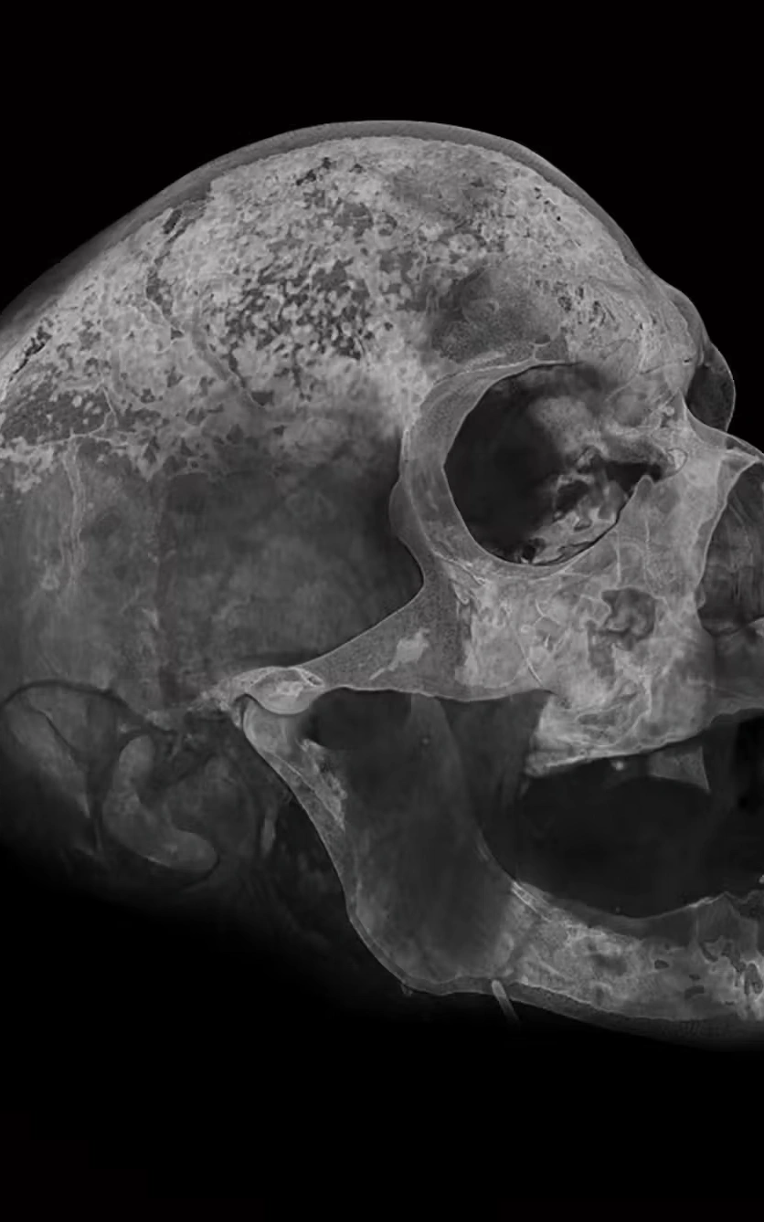Skull x-ray image on black