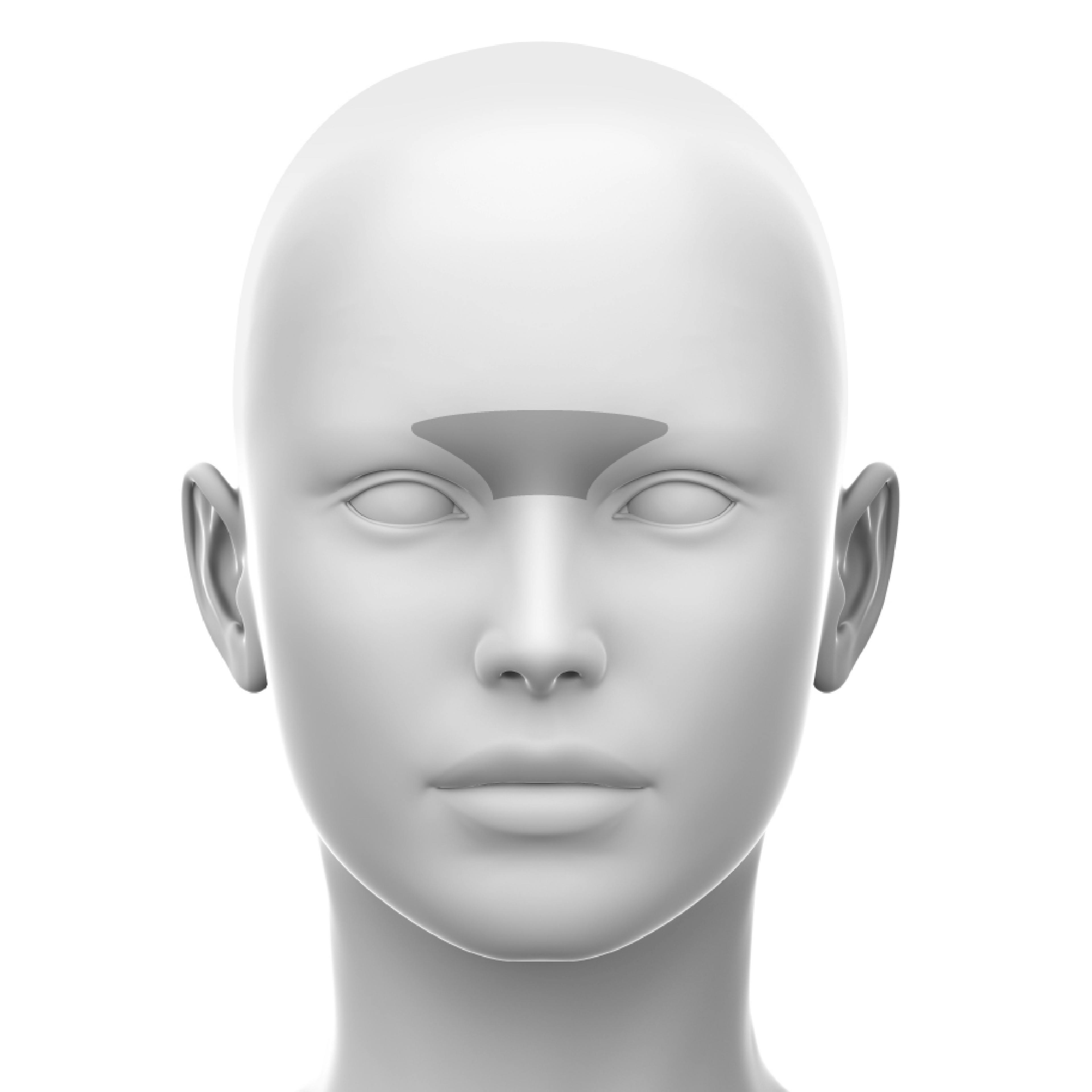 glabella