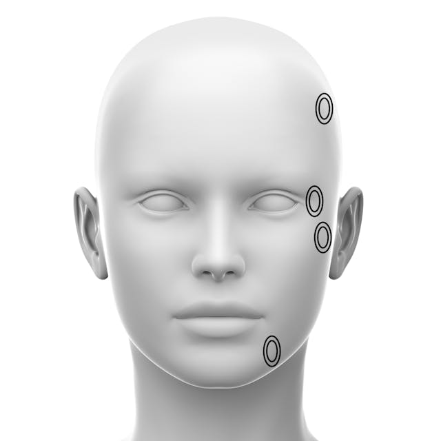 Layers of the Face Online Course Cotofana Anatomy