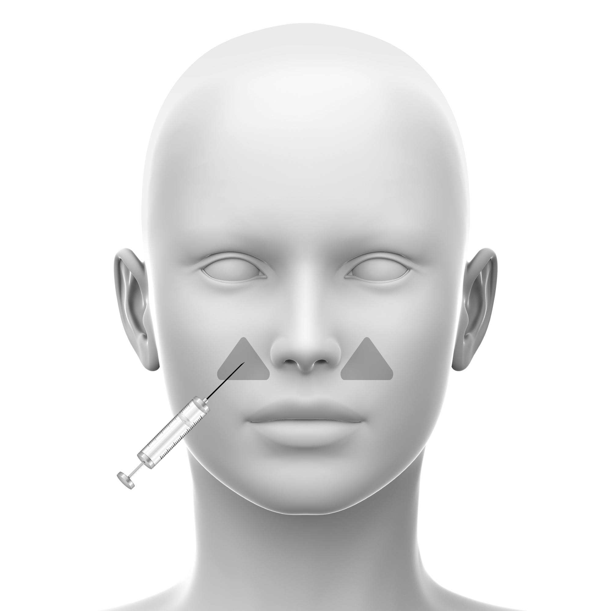 A diagrammatic style showing the LLSAN area of the upper lip