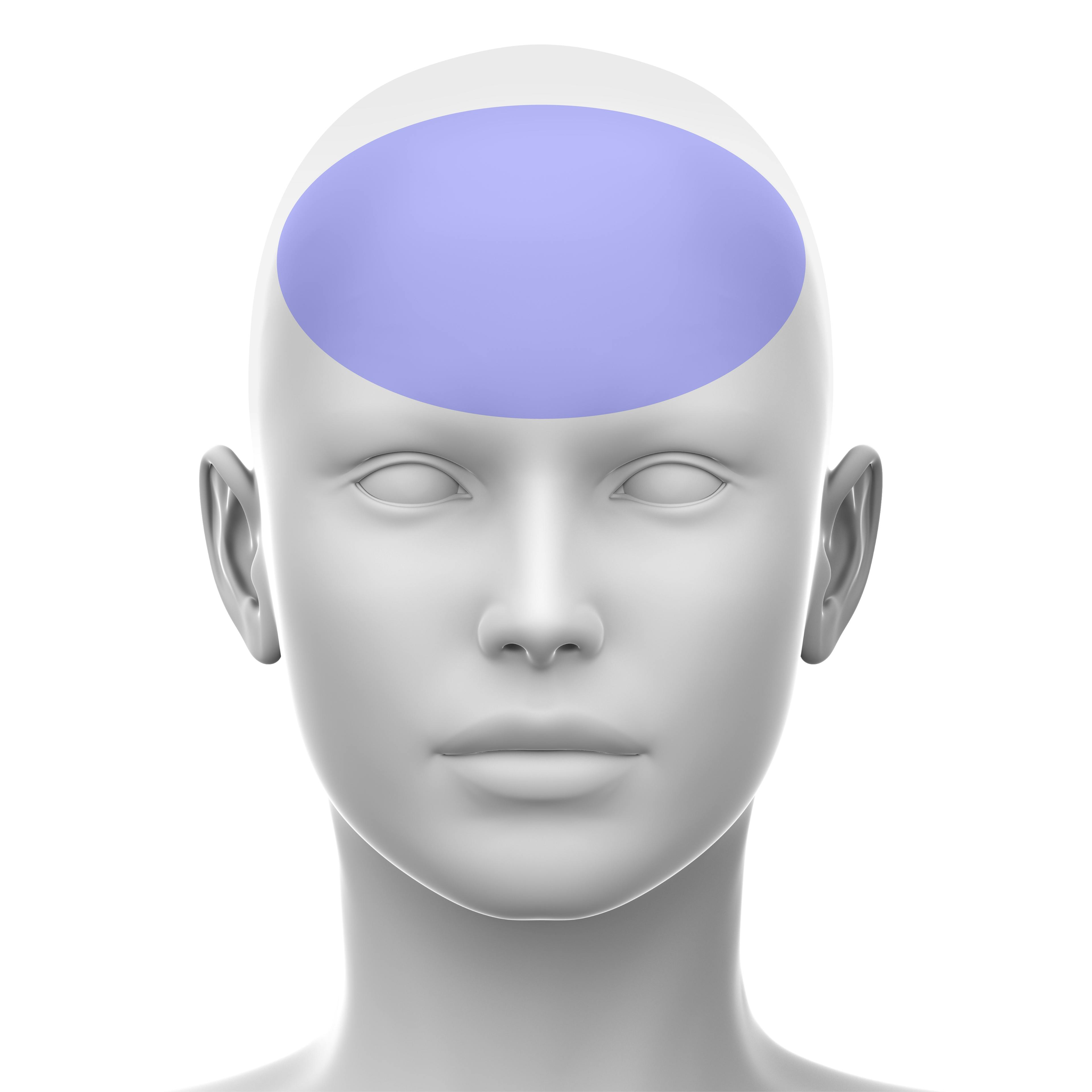 Forehead - soft tissue fillers