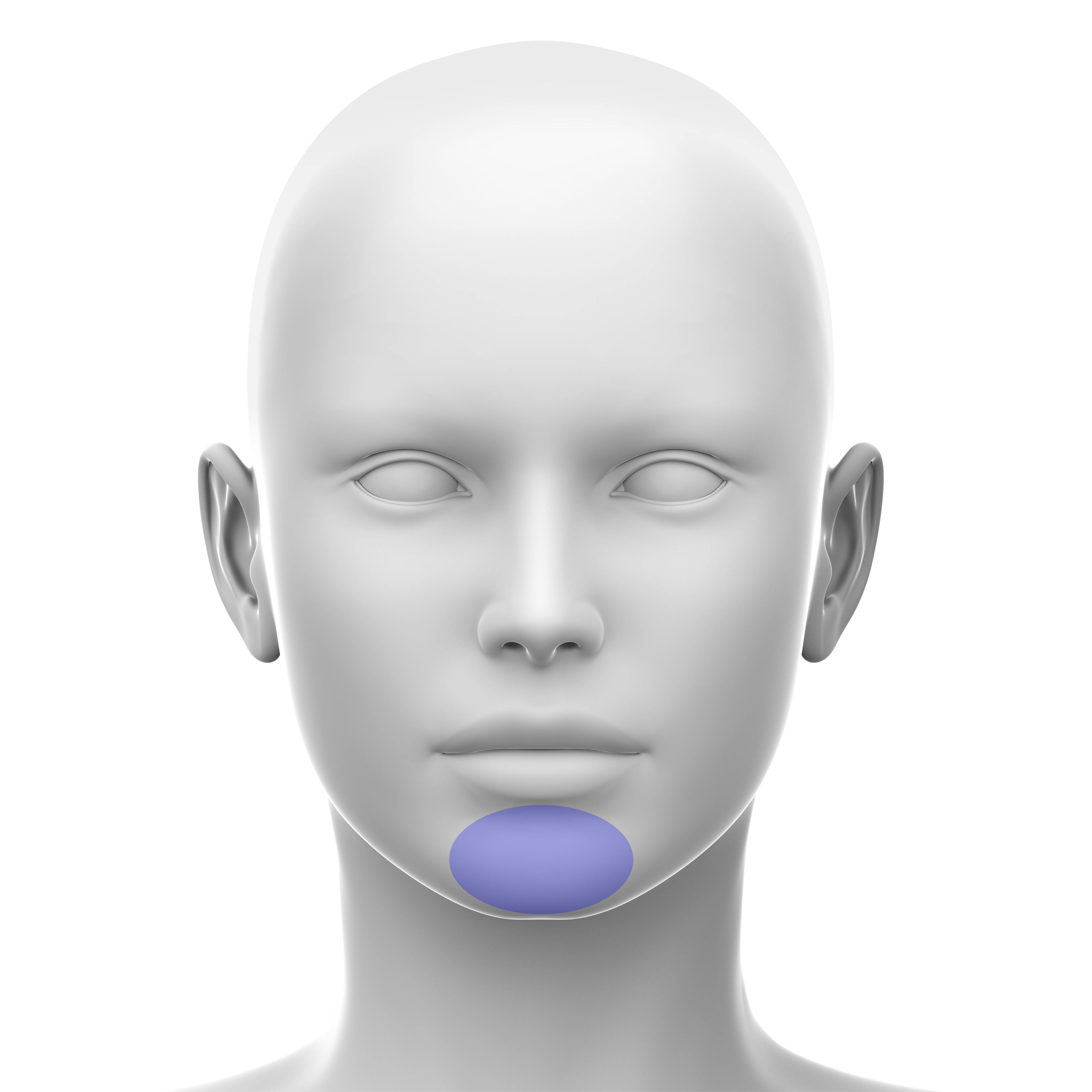 Chin - Soft Tissue Fillers