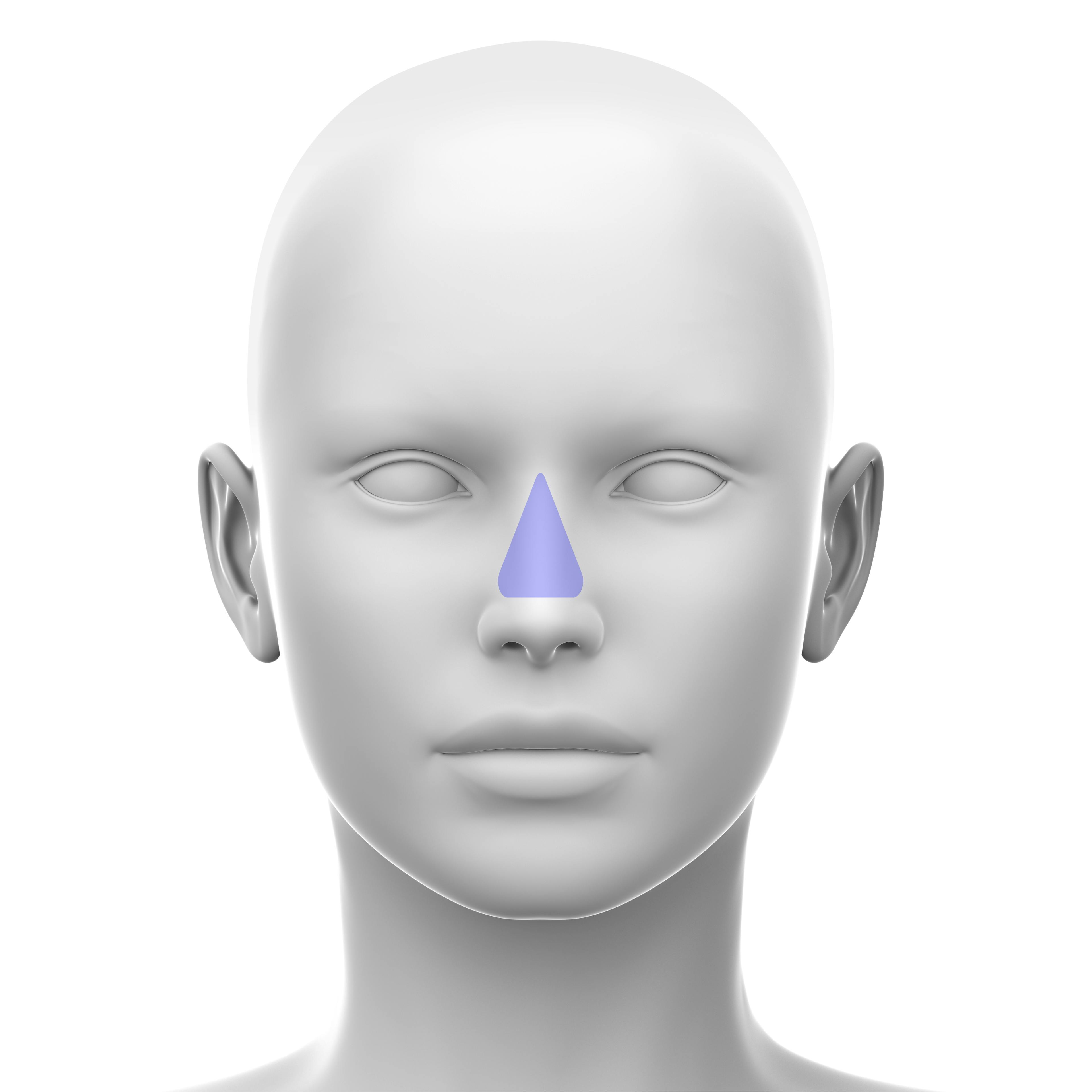 Nose - Soft Tissue Fillers