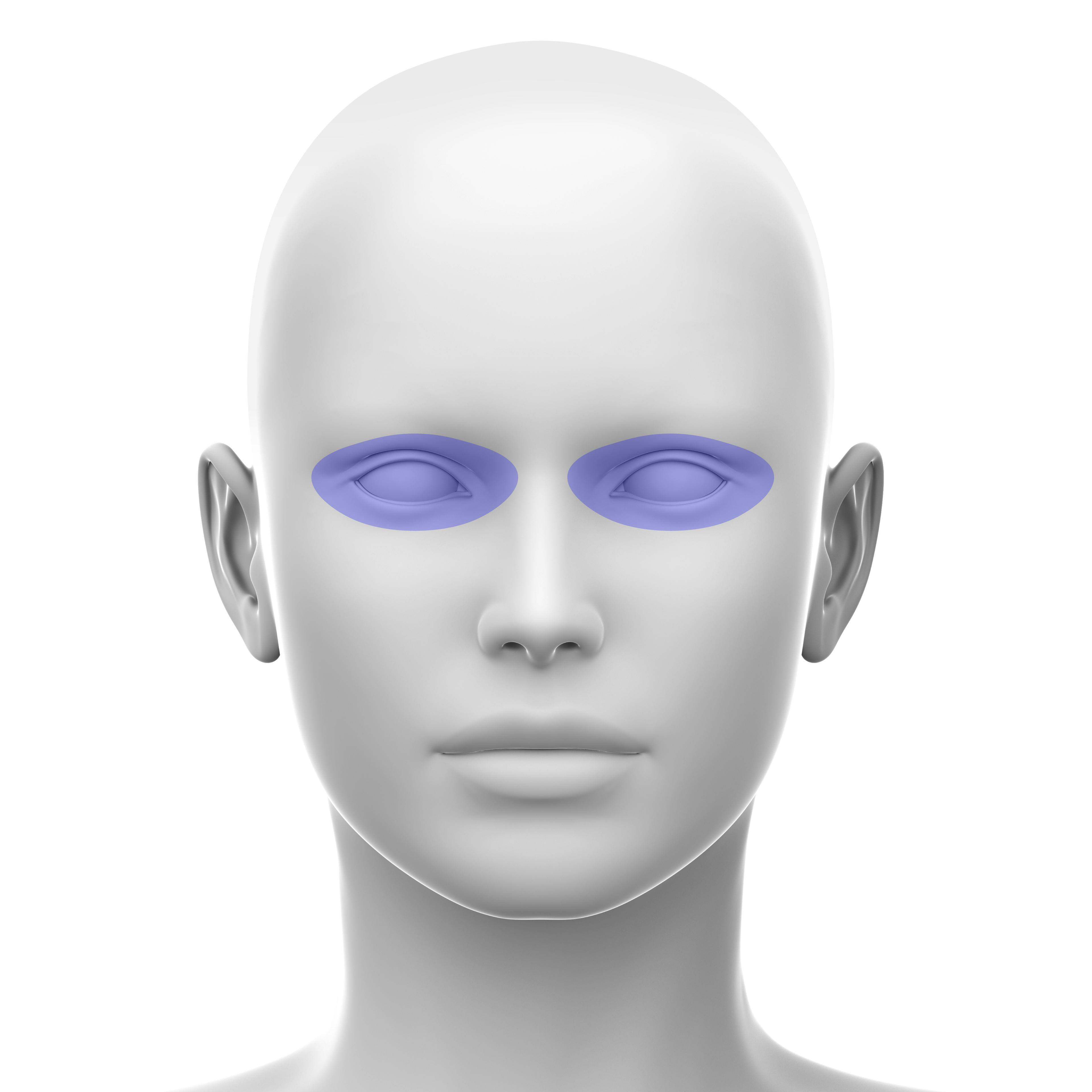 Periorbital - Soft Tissue Fillers