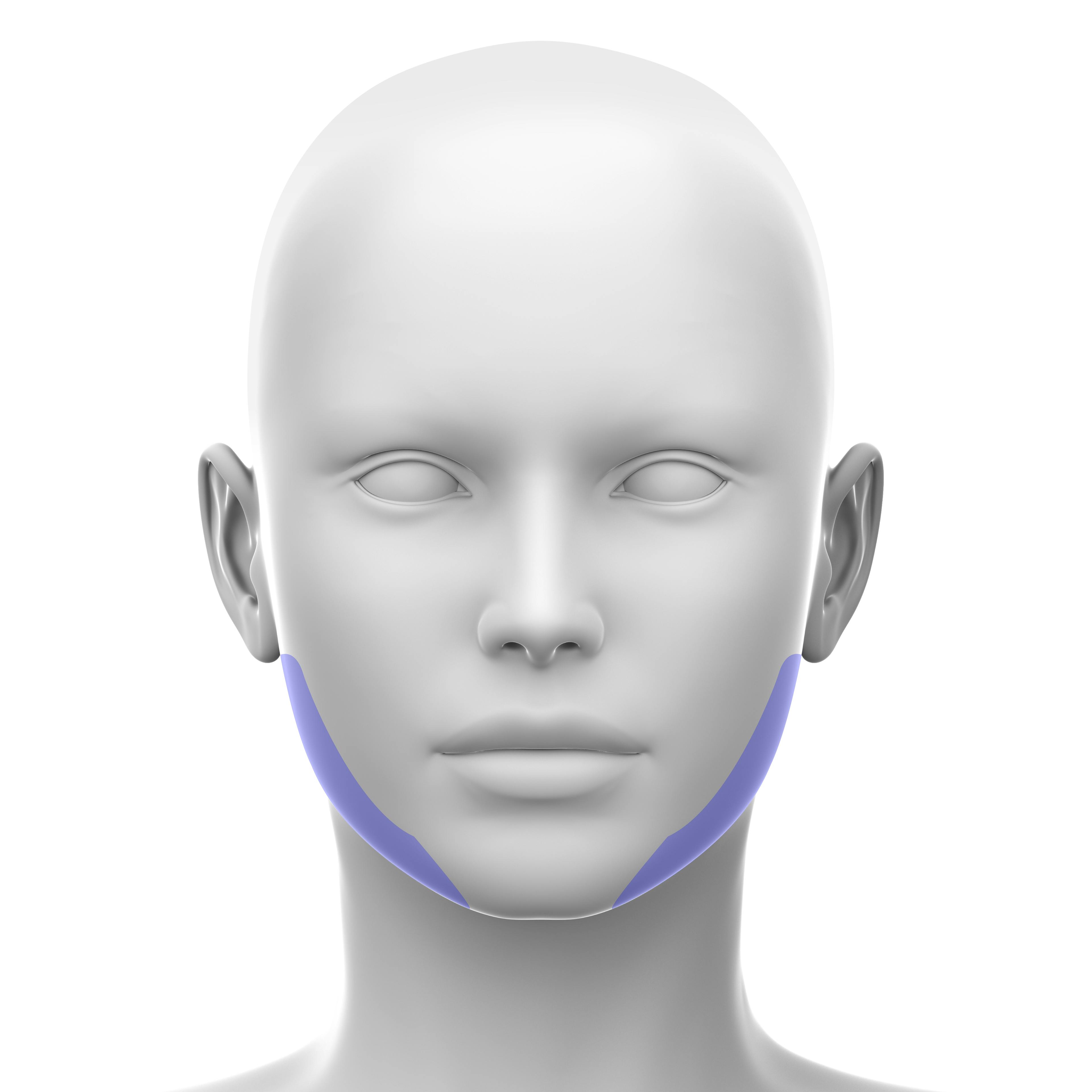 Jawline - soft tissue fillers