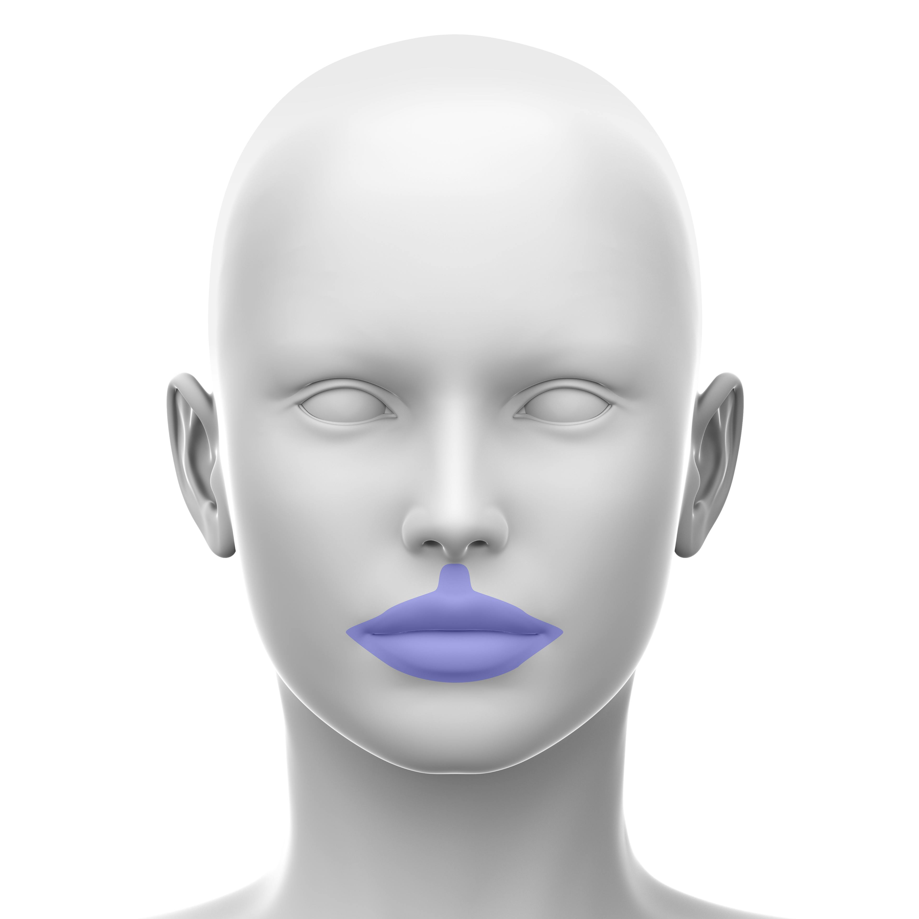 Perioral - soft tissue fillers