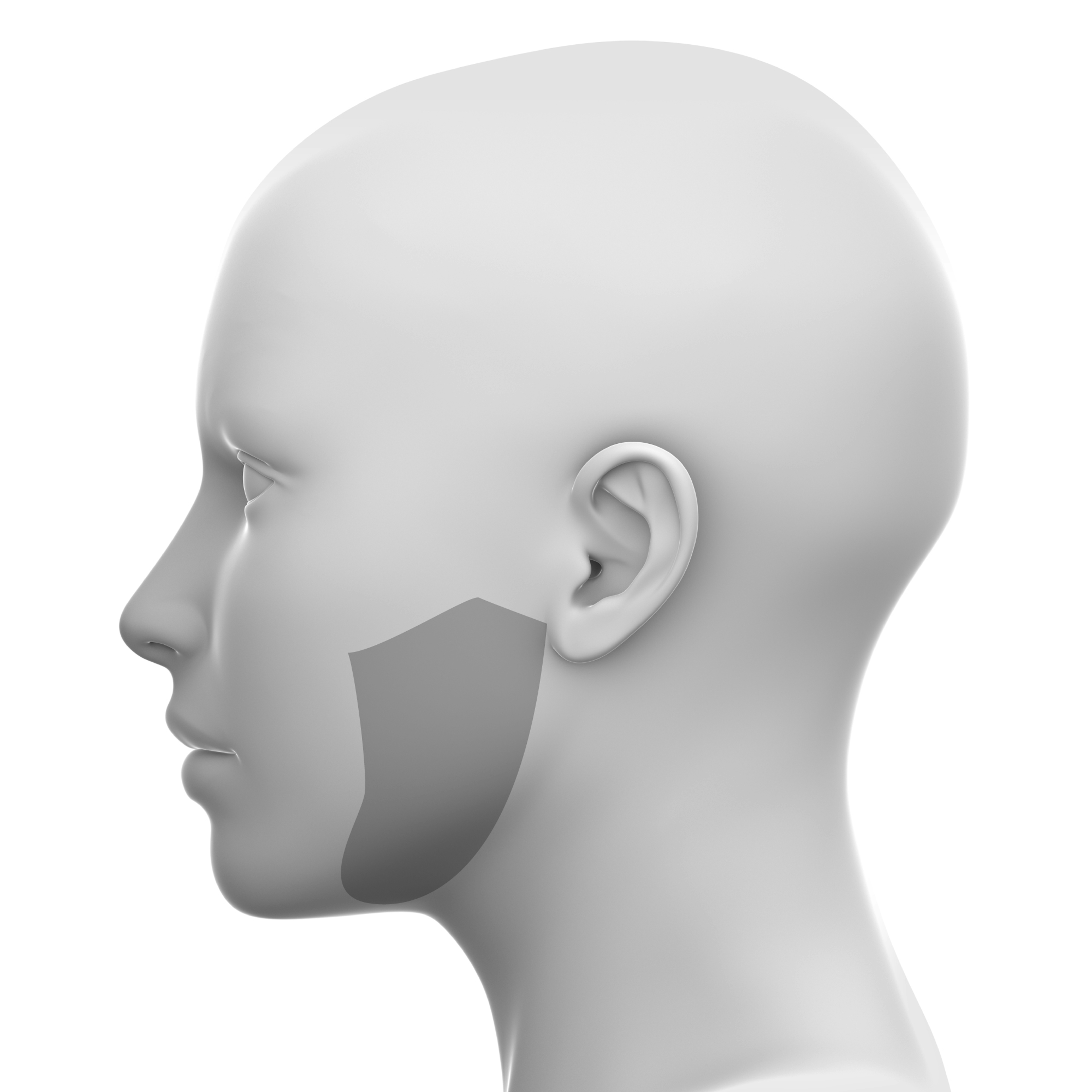 Masseter muscle hypertrophy