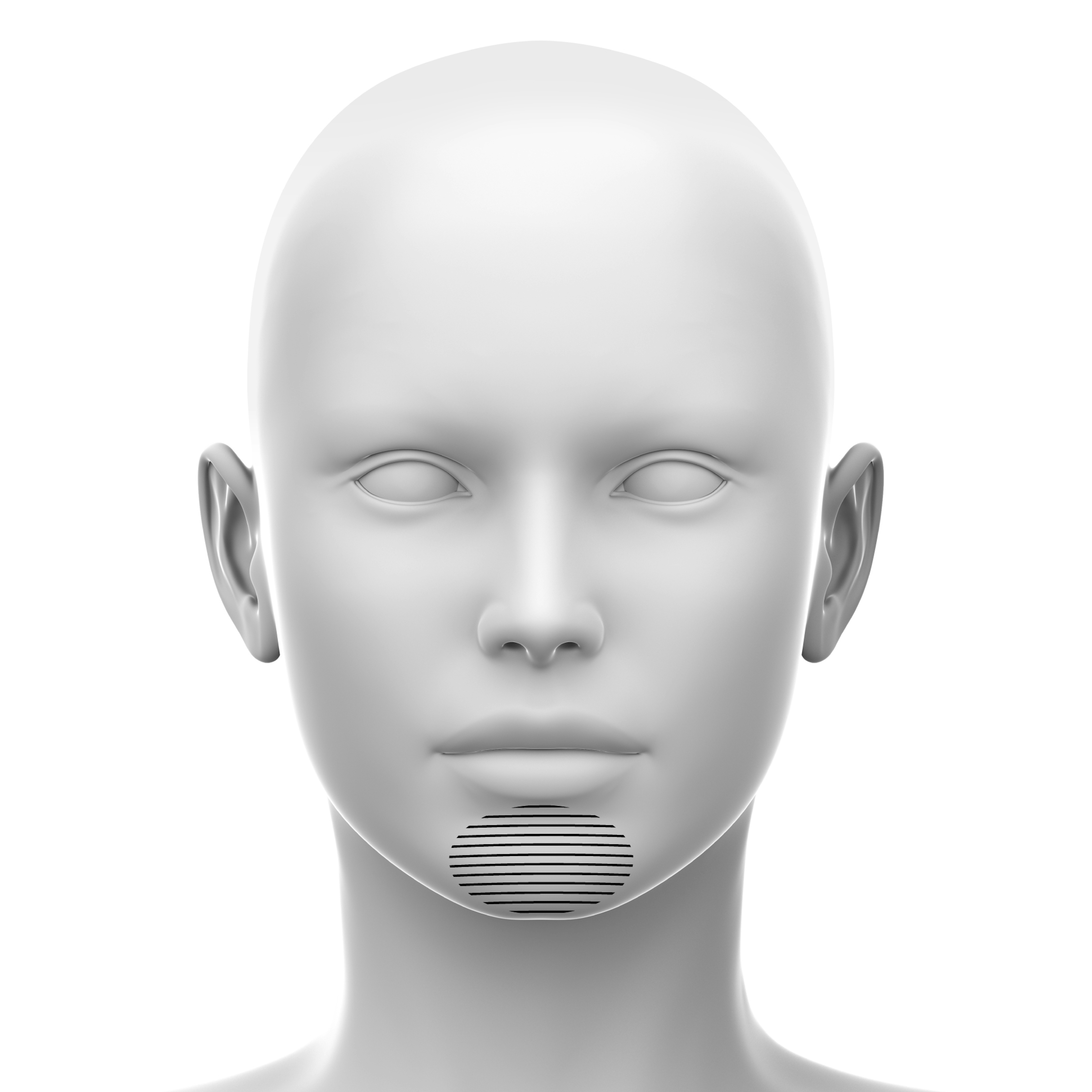 Chin soft tissue fillers