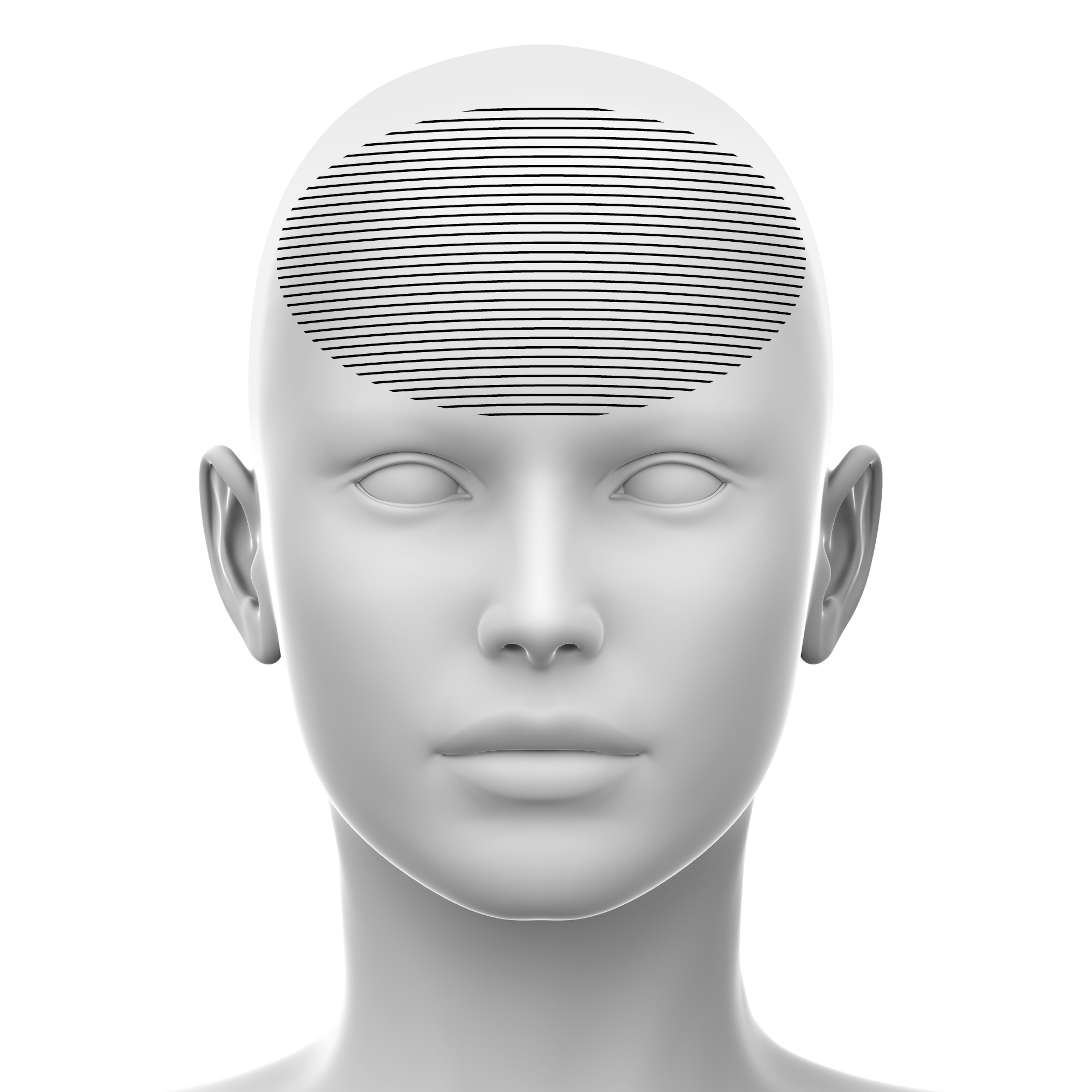 Forehead Soft tissue fillers