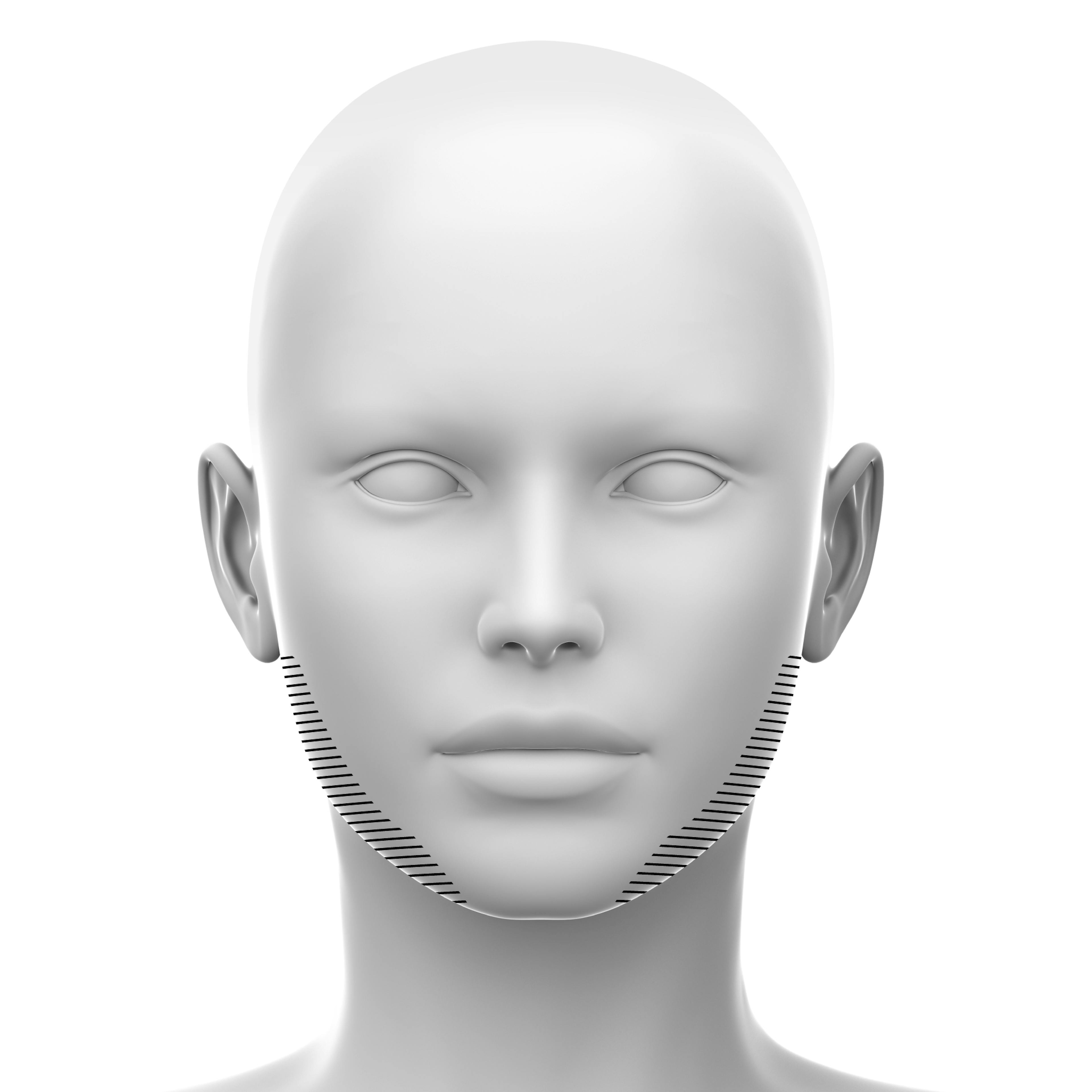 Jawline soft tissue fillers