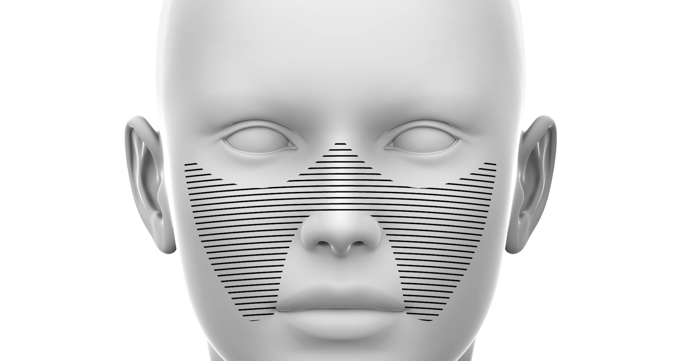 Medial Midface - Soft Tissue Fillers