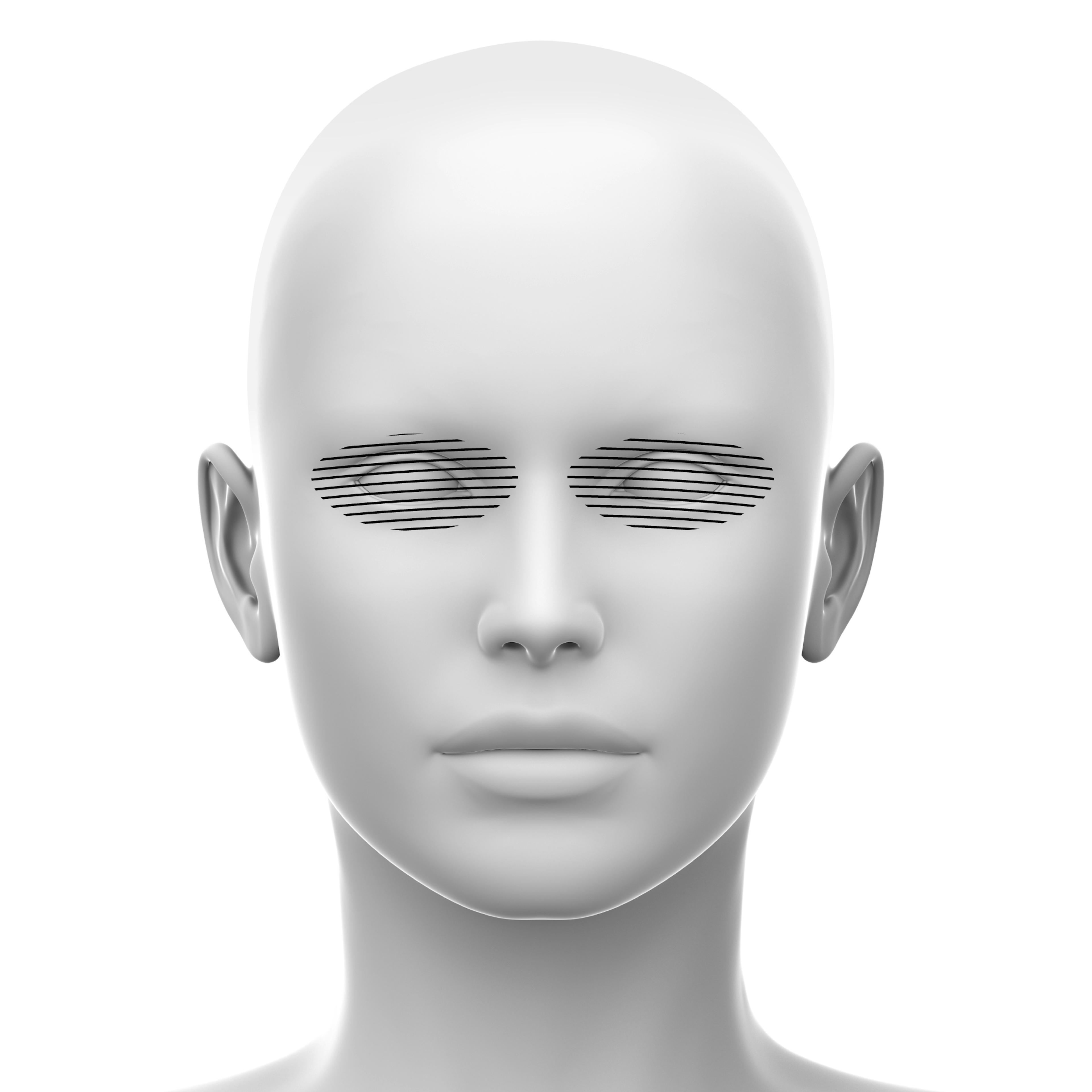 Periorbital soft tissue fillers