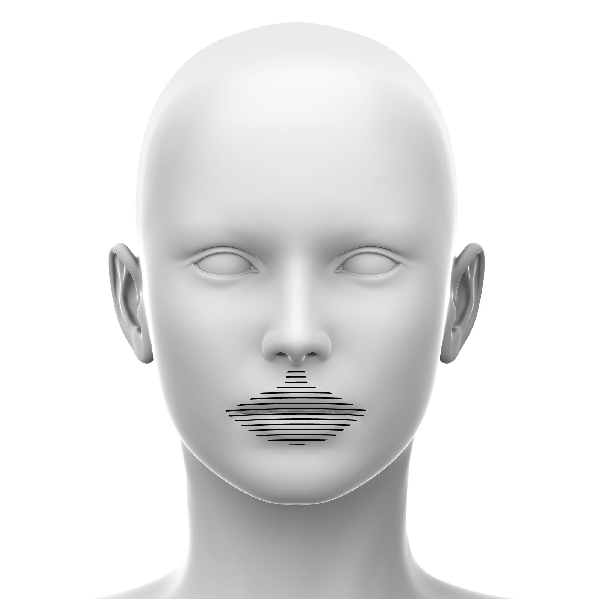 Perioral soft tissue fillers