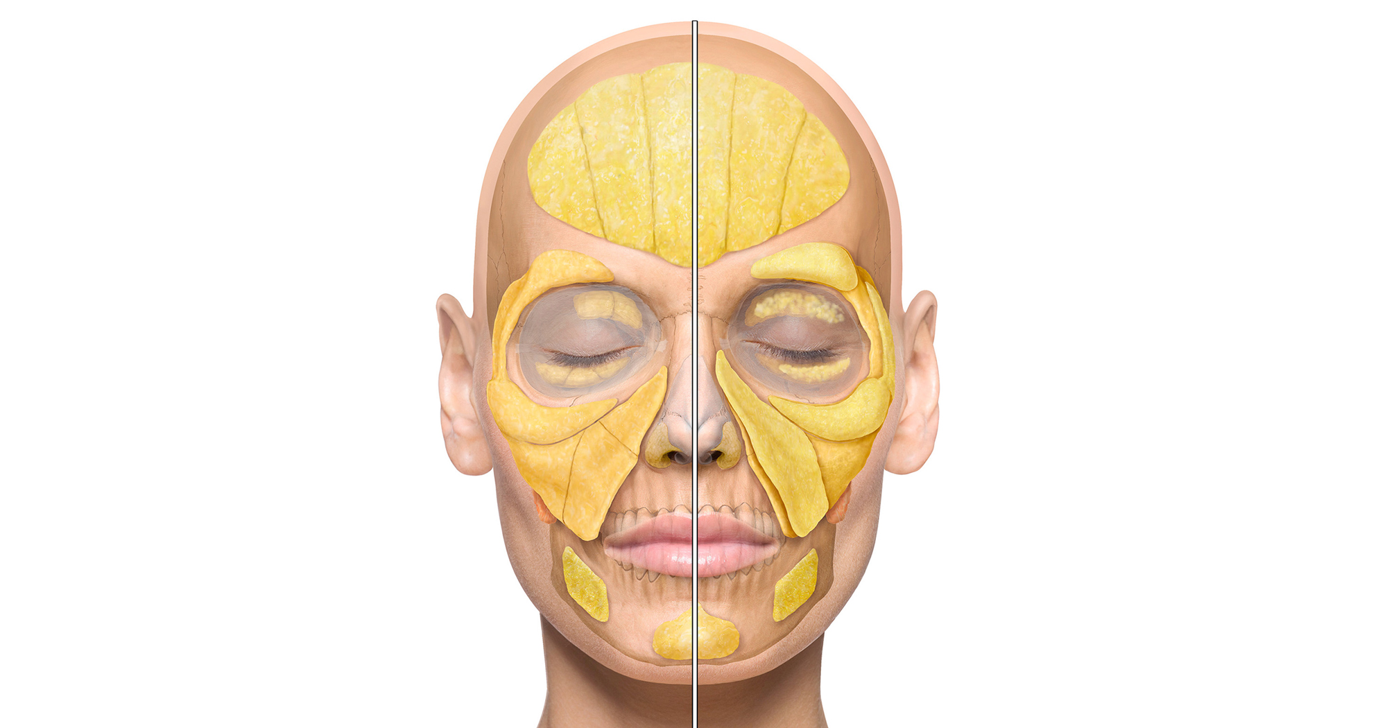 The Intermediate Fatty Layer of the Midface | Cotofana Anatomy