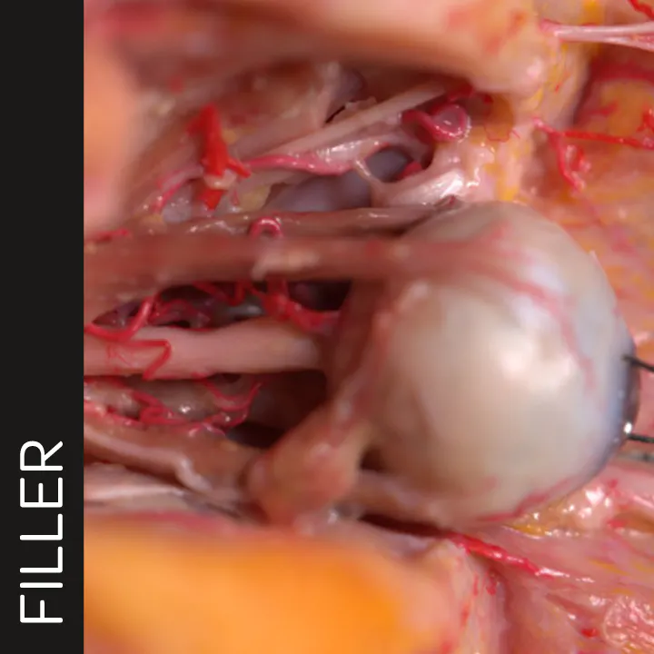 Extended Anatomic Review: The Ophthalmic Artery