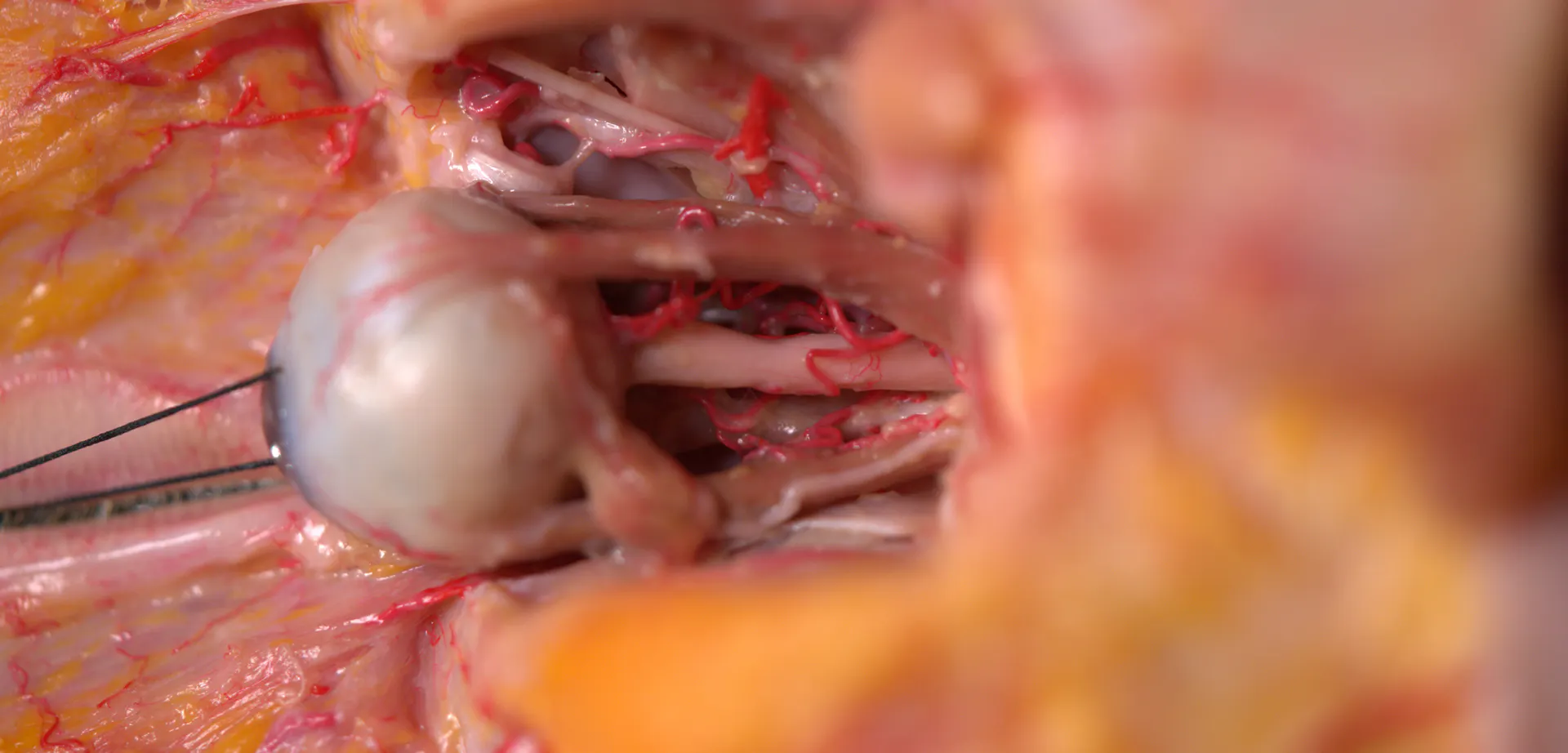 Extended Anatomic Review: The Ophthalmic Artery