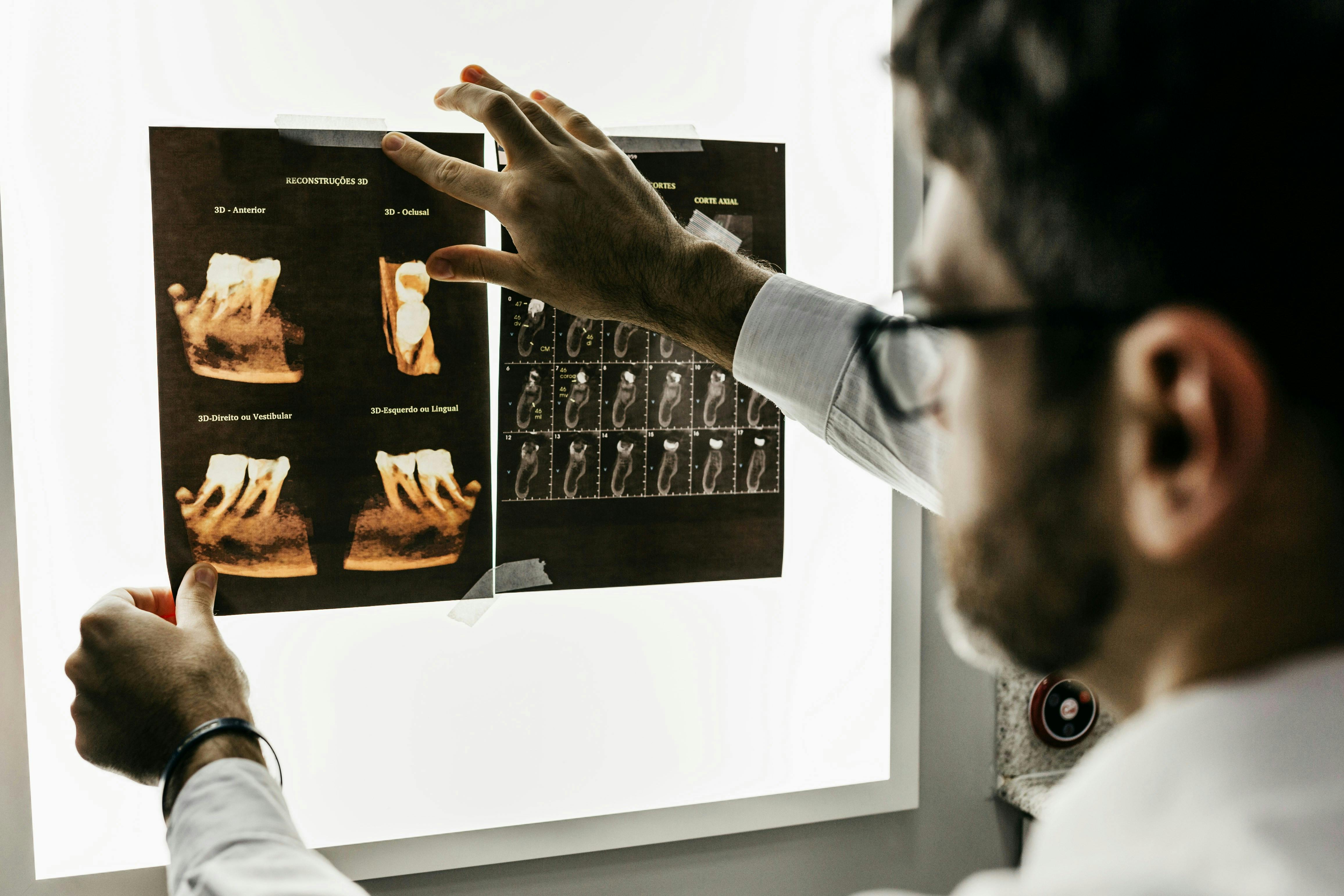 Doctor looking at Xrays