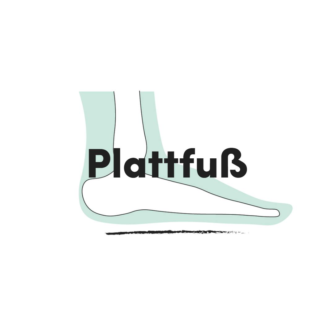 Plattfuss