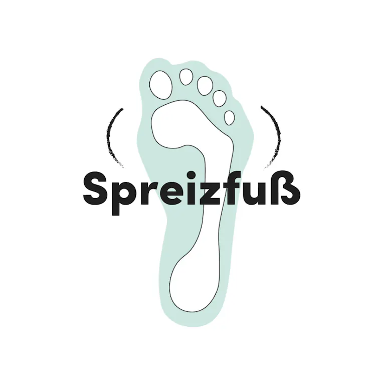Spreizfuss