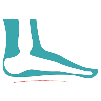 Grafik von einem Senkfuß