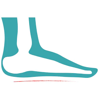 Grafik von Plattfuß