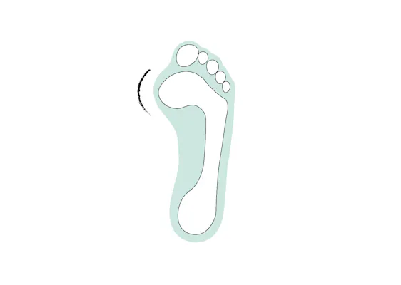 Illustration Hallux Valgus