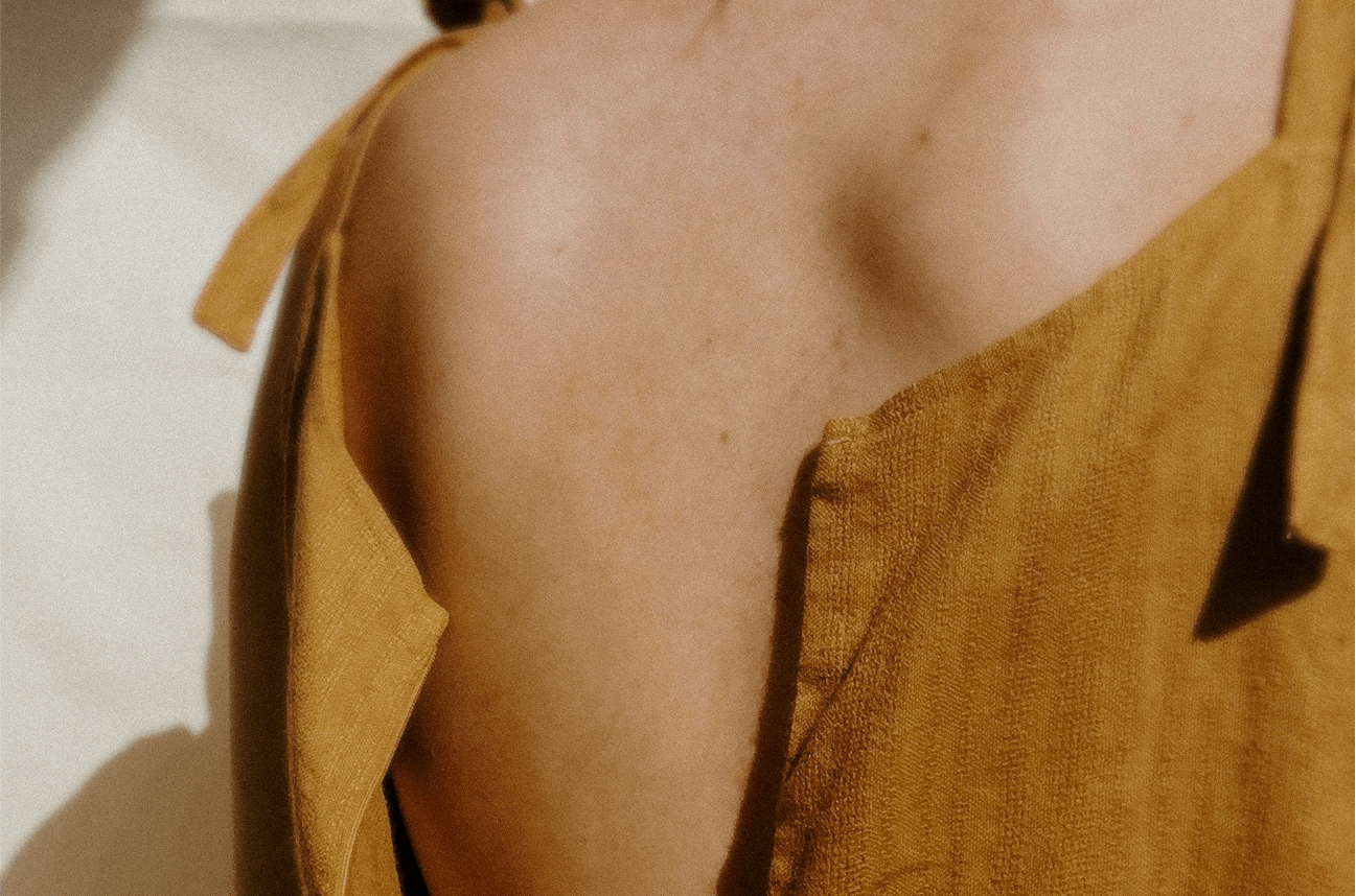 Yellow dress with open back