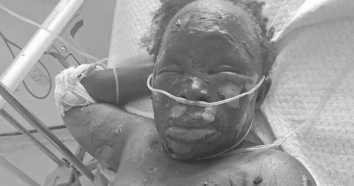 Man burns mother over marital issues