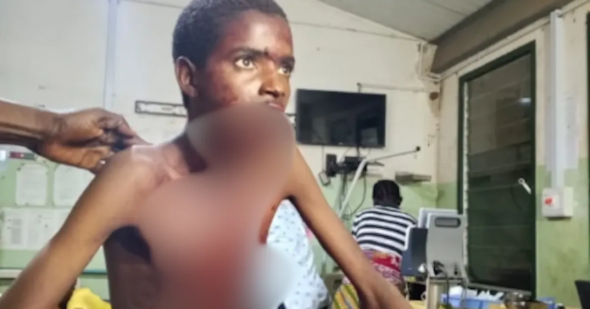 Kidnapped teenager shot as Police close in on suspected gang
