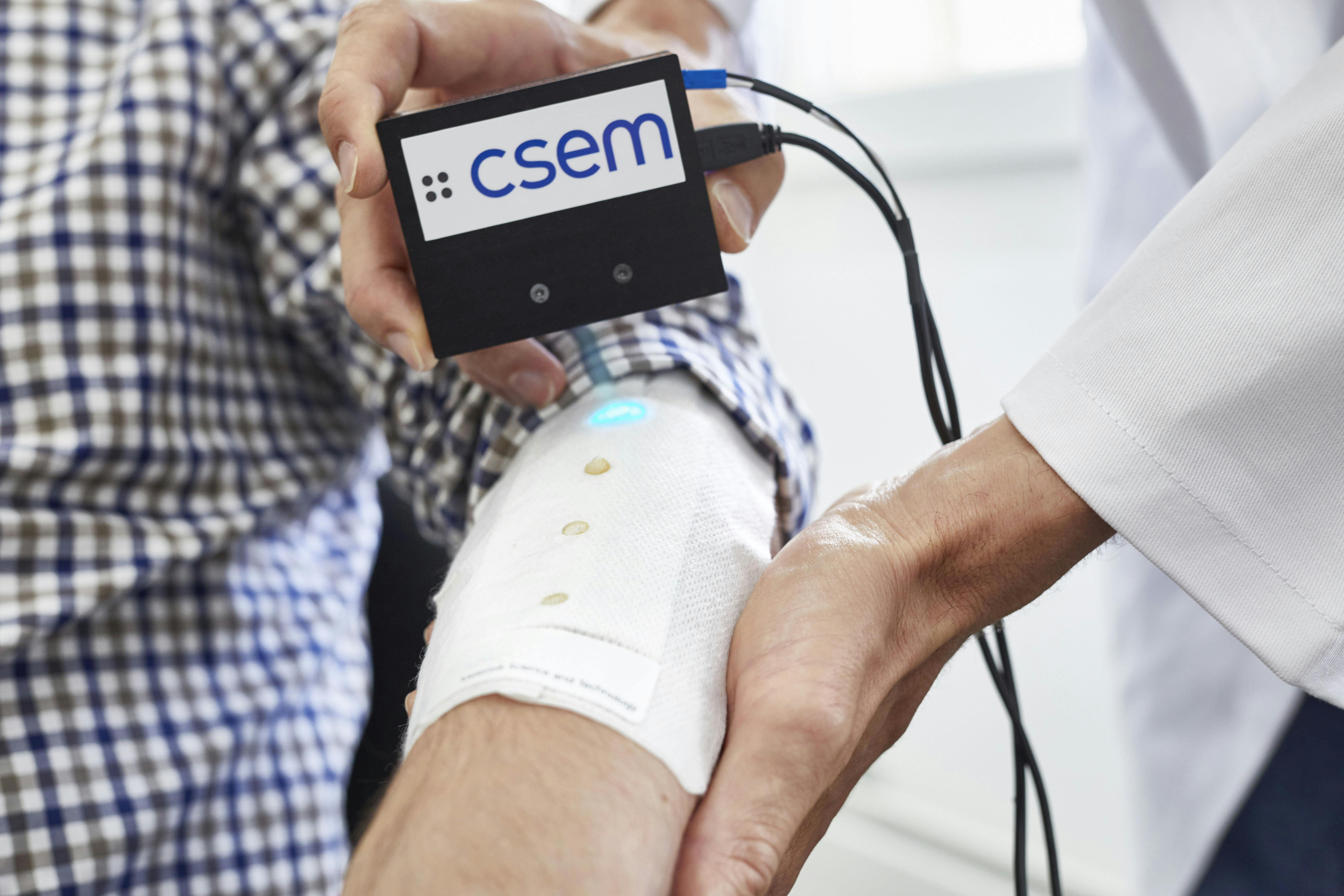 A medical doctor using an optical pH sensor for wound monitoring on a patient's arm. 