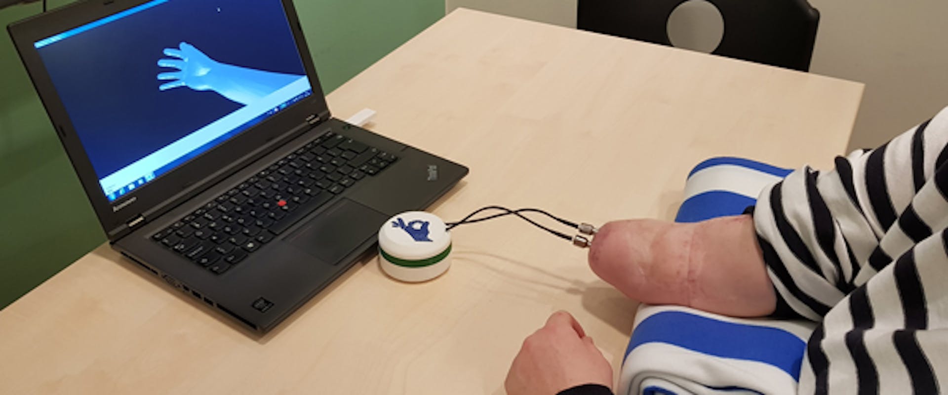 Hand prosthesis