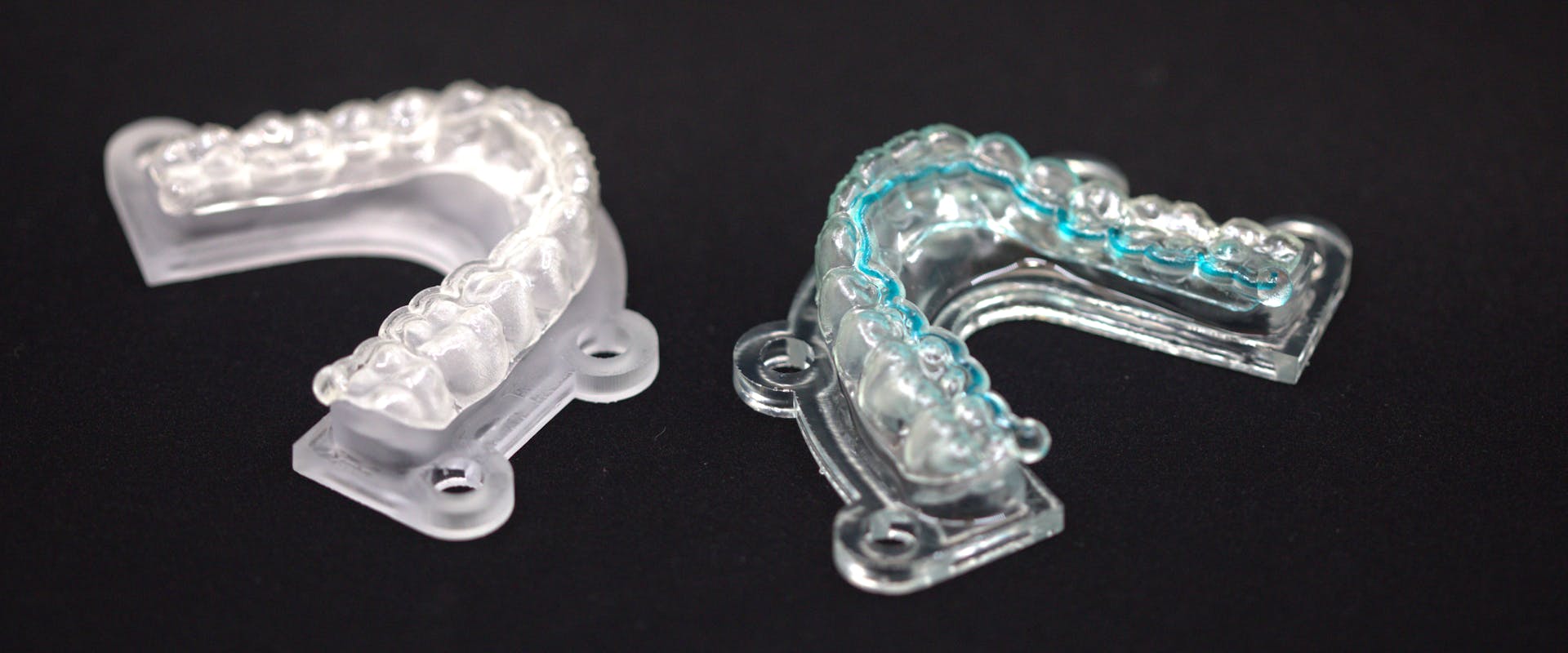 Two prototypes of “Active Aligners” equipped with antibacterial diffusers. The one on the left represents the transparent aligner prototype in its final appearance. The prototype on the right contains a blue liquid highlighting the innovation: a 3D-printed microchannel system.