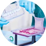 Customized skin tissue grafts