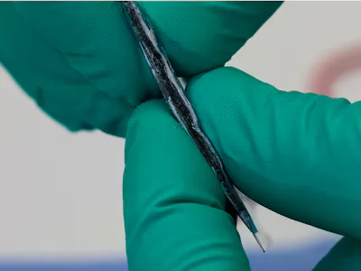 Solid state of a Li-metal battery