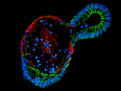 Fluorescent organoid with colors corresponding to specific proteins and functions