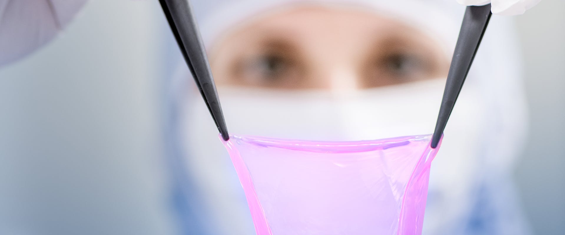 CUTISS personalized bio-engineered skin graft ready for transplantation