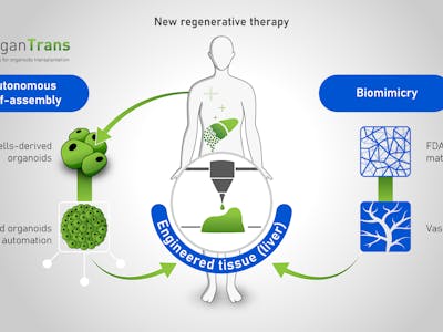 Organtrans - new regenerative therapy