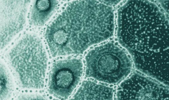 blog_Tutto quello che devi sapere su prebiotici, probiotici e postbiotici _ benefici e fonti naturali