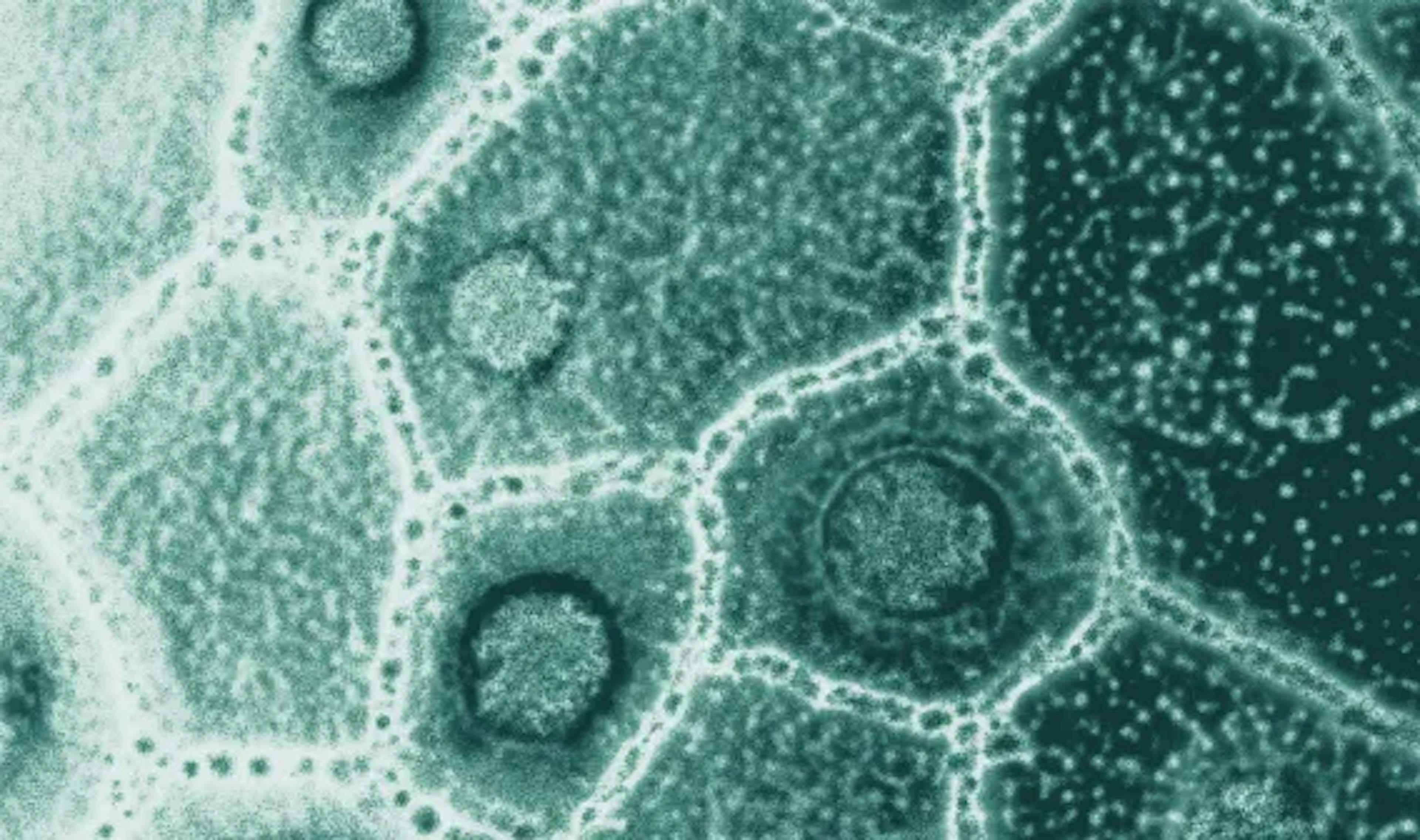 blog_Tout savoir sur les prébiotiques, probiotiques et postbiotiques _ bienfaits et sources naturelles