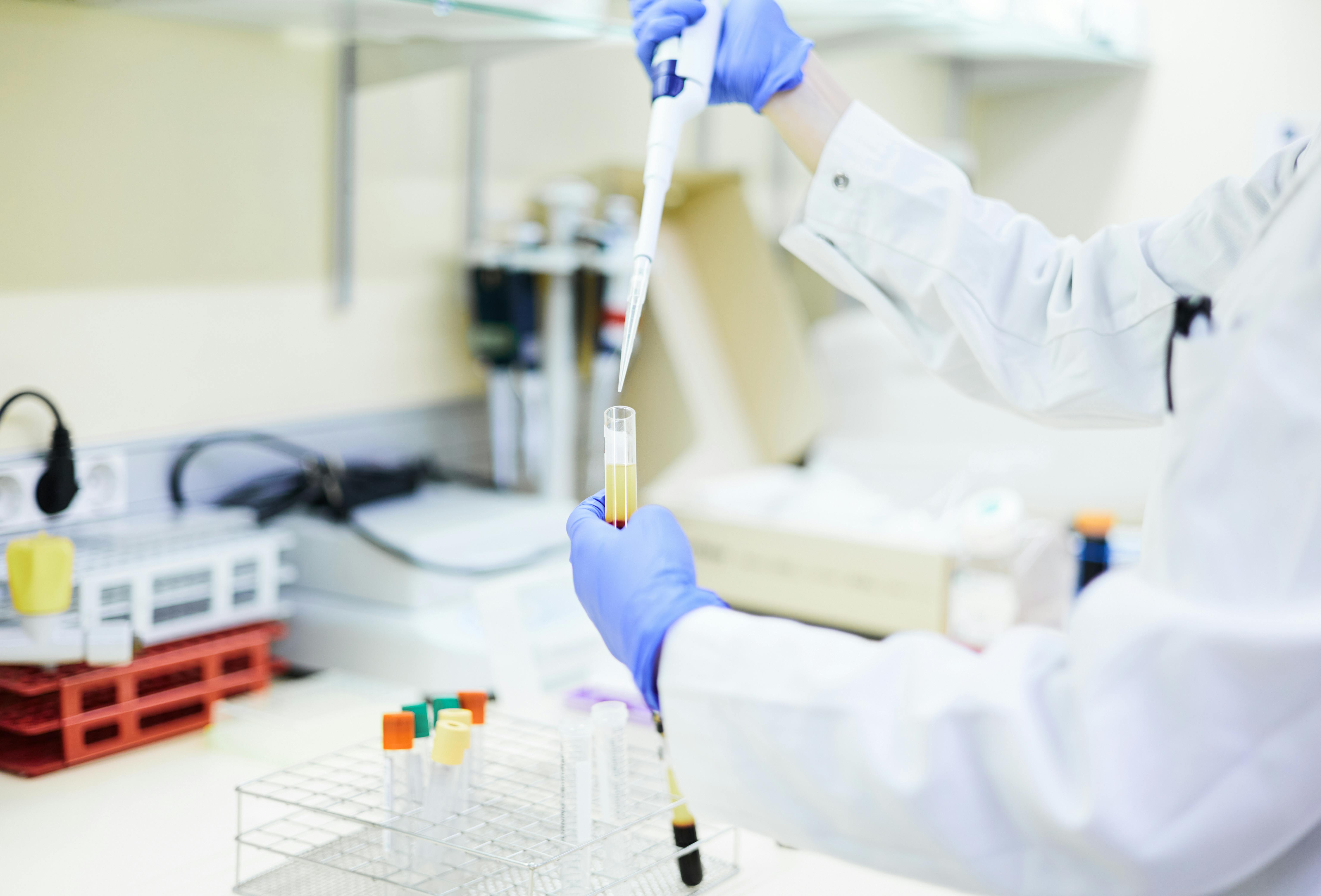 A scientist analyses a blood sample with a pipette in the laboratory.