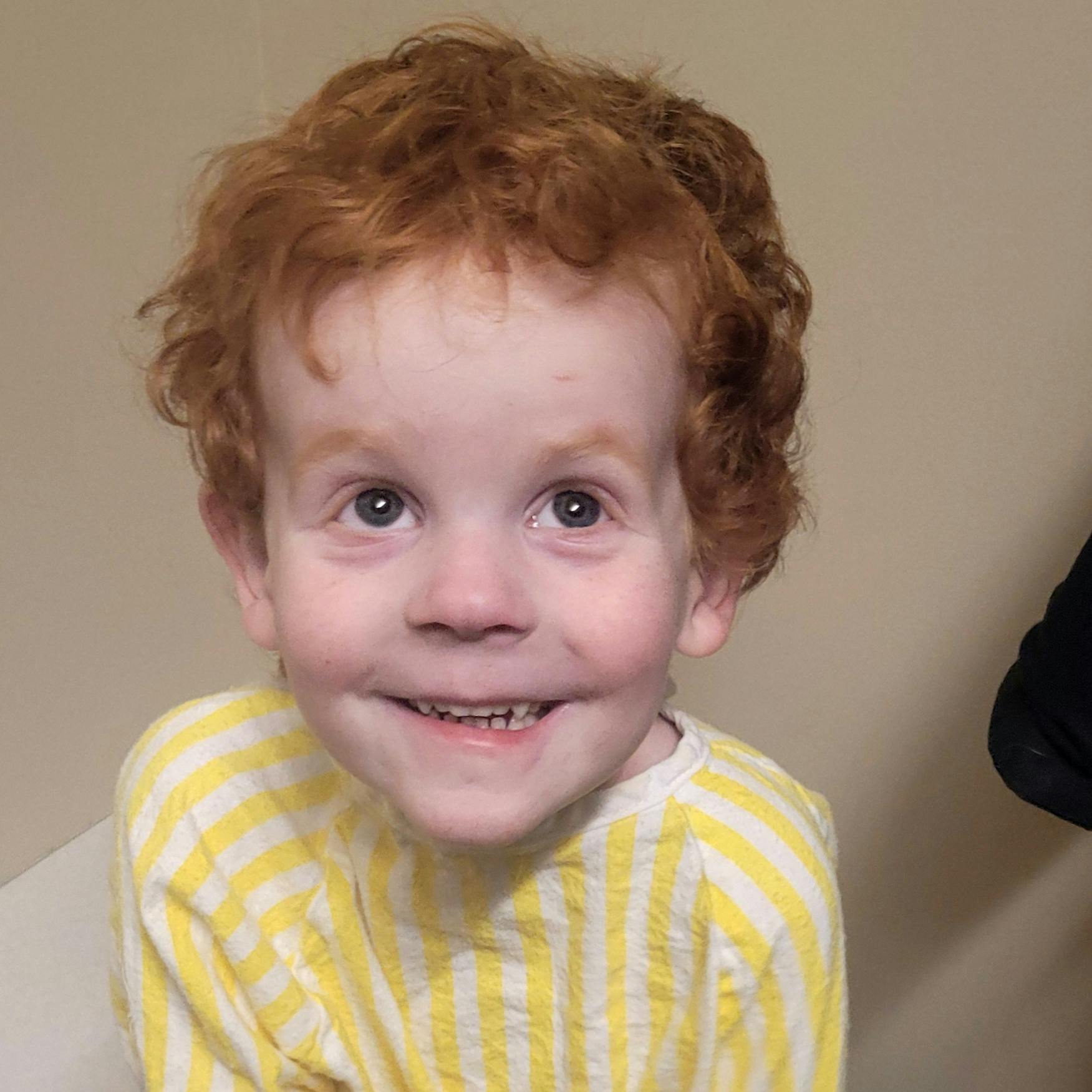 Zachary wearing his hospital gown.